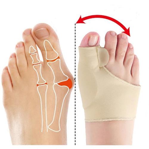 Orthopedische Teen Corrector Huidkleur - Sandra