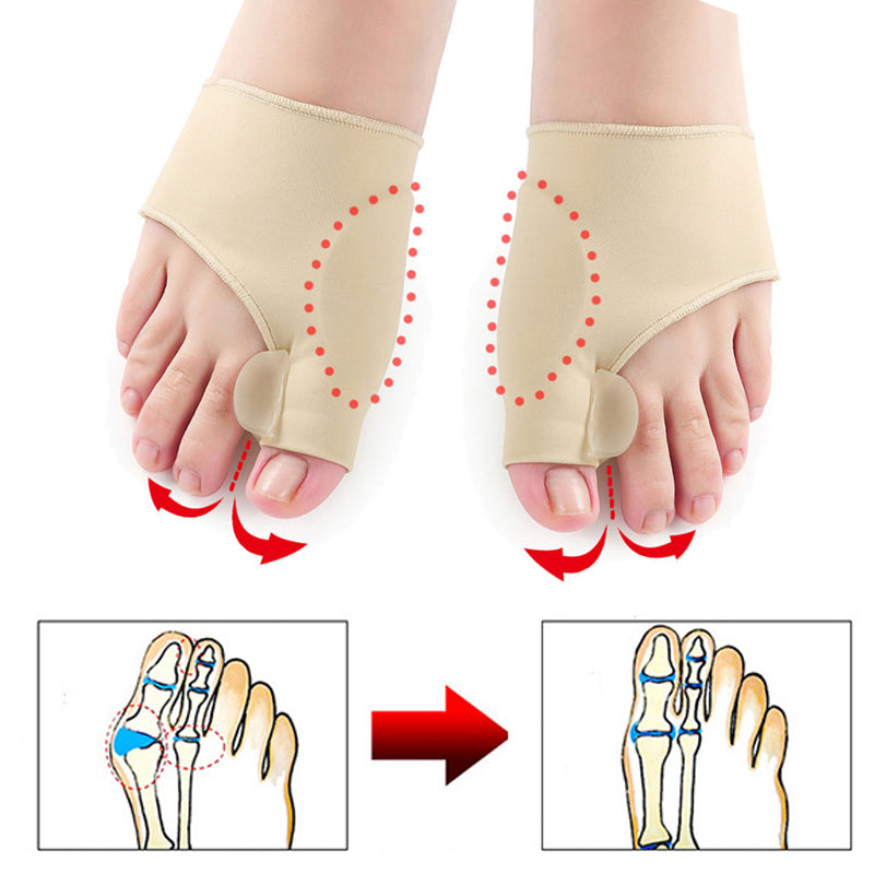 Sophie - Orthopedische Beige Hallux Valgus Corrector